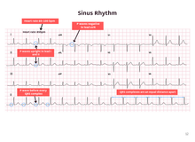Load image into Gallery viewer, ECG Pocketbook 2nd Edition - Digital version