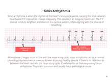 Load image into Gallery viewer, ECG Pocketbook 2nd Edition - Digital version