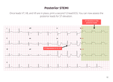 Load image into Gallery viewer, ECG Pocketbook 2nd Edition - Digital version