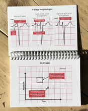 Load image into Gallery viewer, ECG Pocketbook 2nd Edition