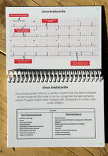 Load image into Gallery viewer, ECG Pocketbook 2nd Edition