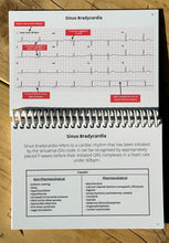 Load image into Gallery viewer, ECG Pocketbook 2nd Edition