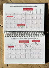 Load image into Gallery viewer, ECG Pocketbook 2nd Edition