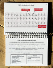 Load image into Gallery viewer, ECG Pocketbook 2nd Edition