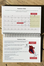 Load image into Gallery viewer, ECG Pocketbook 2nd Edition