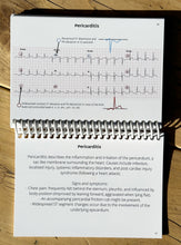 Load image into Gallery viewer, ECG Pocketbook 2nd Edition
