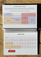 Load image into Gallery viewer, ECG Pocketbook 2nd Edition