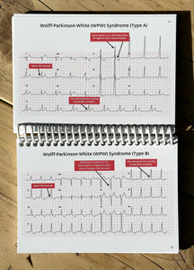 ECG Pocketbook 2nd Edition