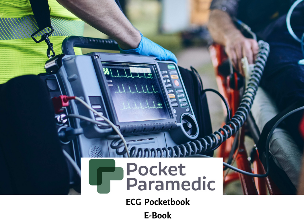 ECG Pocketbook (Digital version only)