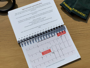 ECG Pocketbook
